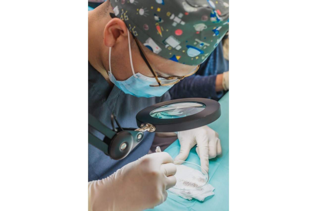 Adcure Clinic, número uno en la técnica de implantación DHI