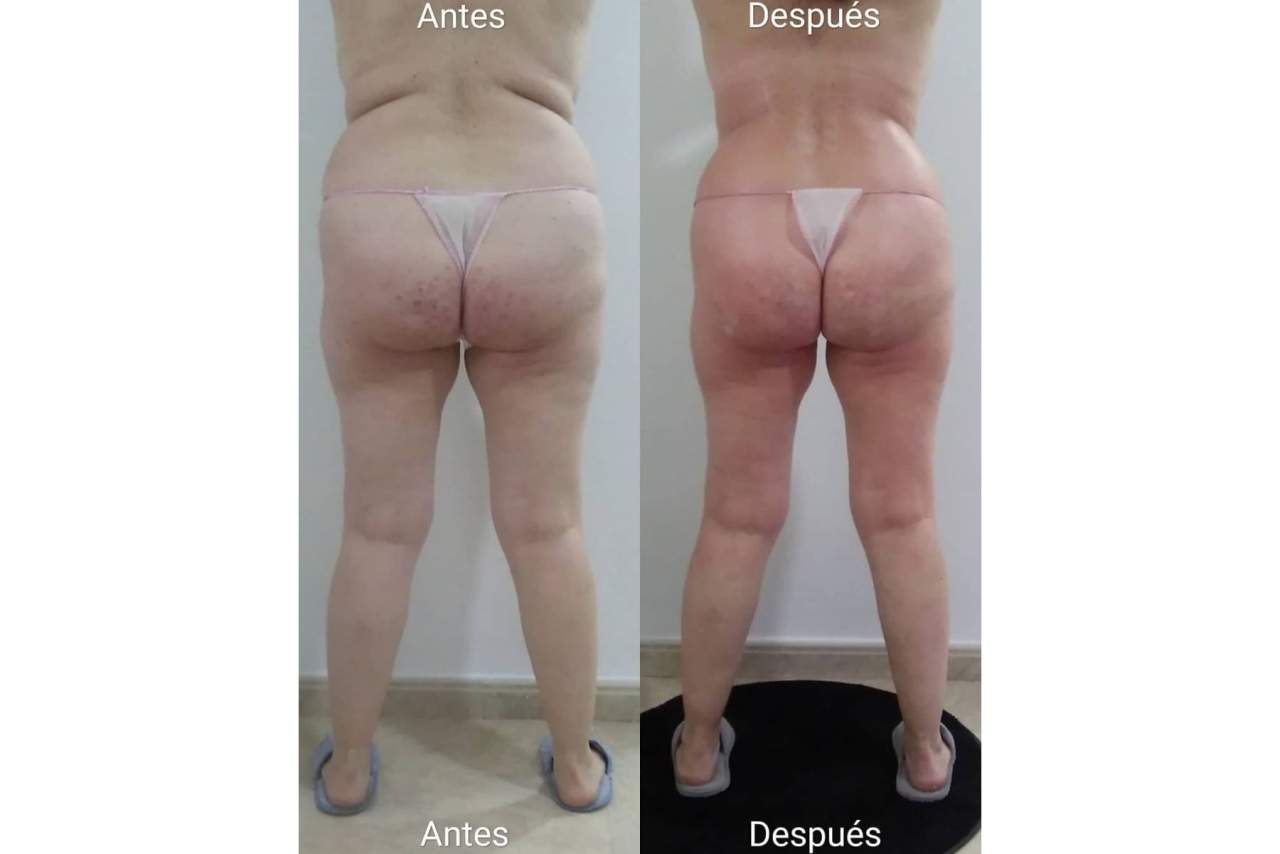 El Centro de Estética Vanesa Vendrell es el centro tendencia, en el corazón de Valencia, para tratamientos reductores y anticelulíticos