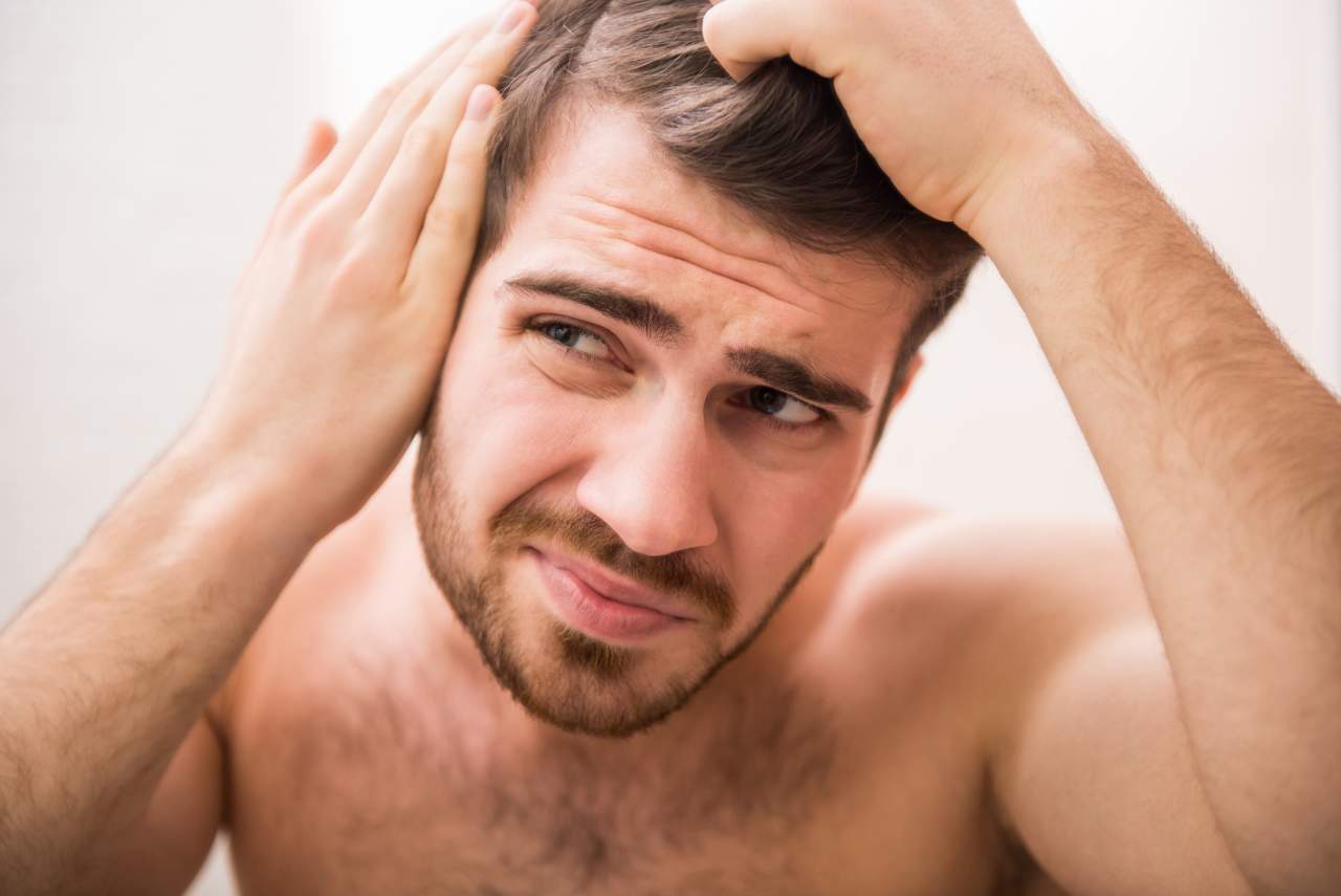 Un 42% de hombres en España son calvos. El método DHI por Dr. Bern Barbehito puede retrasar ese efecto