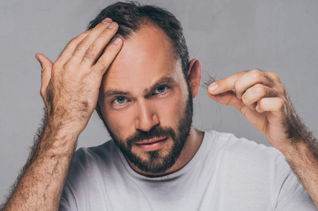 El doctor Bruno Jacobovski y sus técnicas de injerto capilar en Barcelona