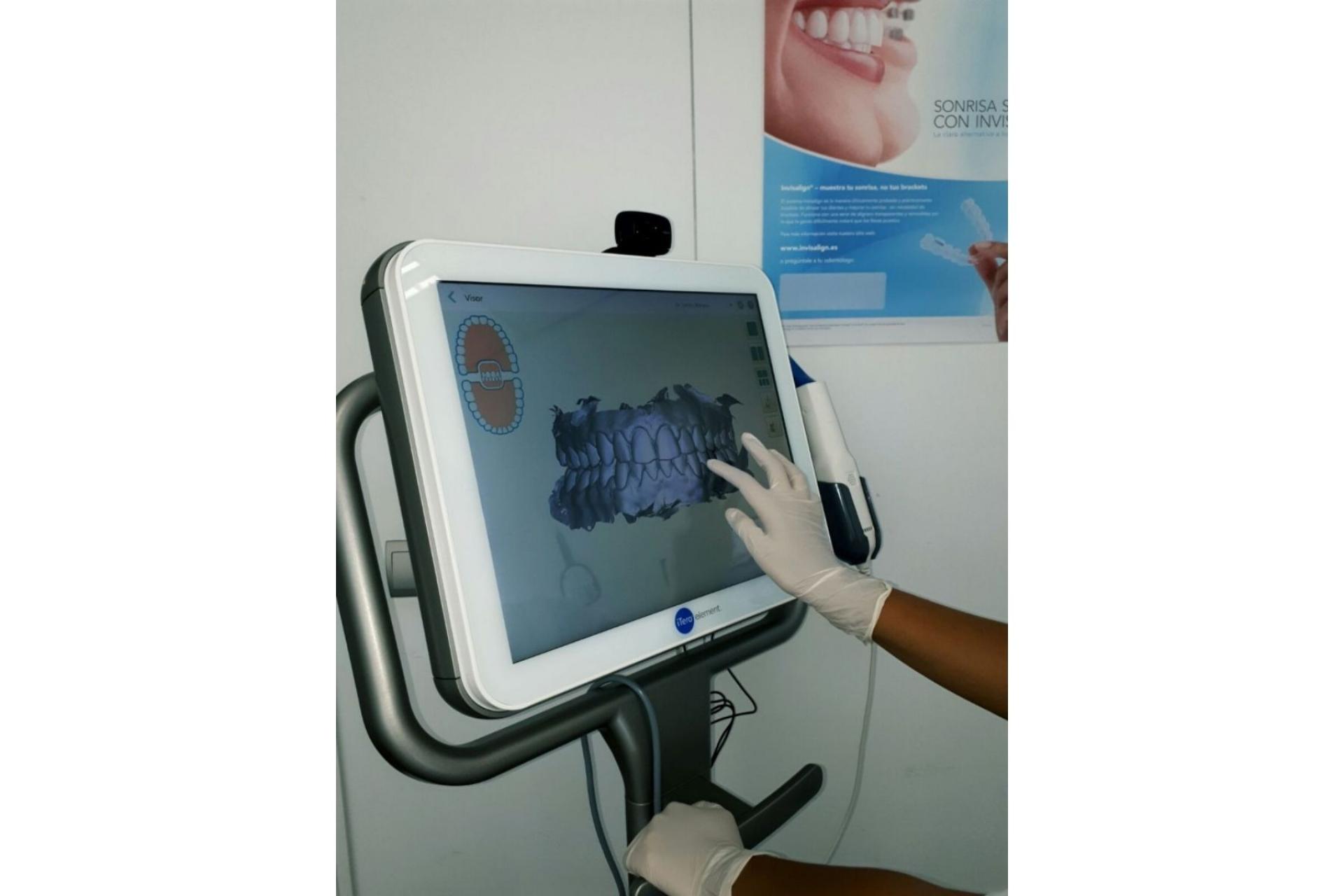 La única clínica en Barcelona especializada en ortodoncia invisible Invisalign® es la Clínica de Ortodoncia Mariana Sacoto Navia