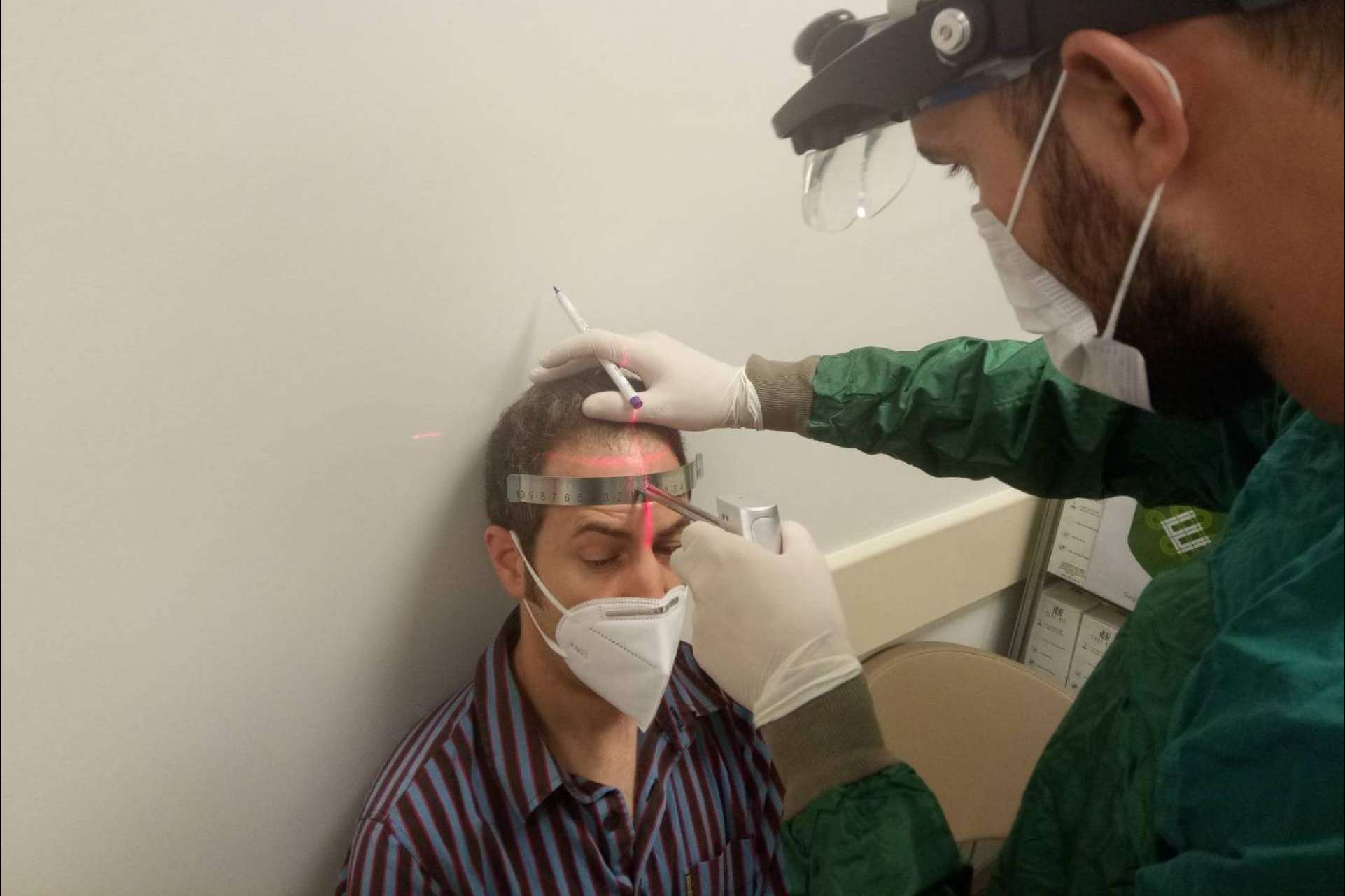 El precio de un trasplante capilar en Turquía en la clínica española Fue Hair Transplant System
