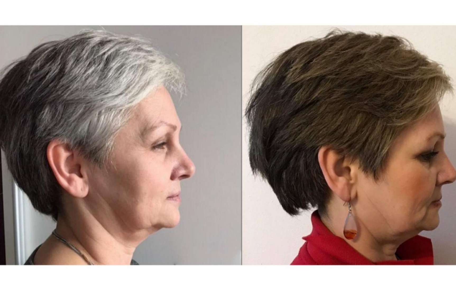 Loción GR-7 Professional se establece como respuesta al Cómo tapar las canas sin tinte