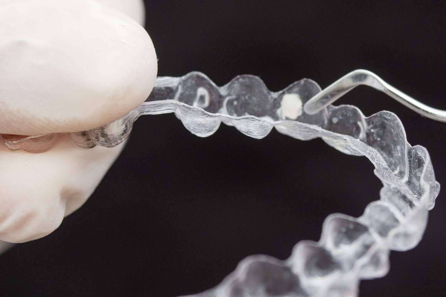 Clínica dental Murcia: variedad de tratamientos en la Clínica Vélez & Lozano