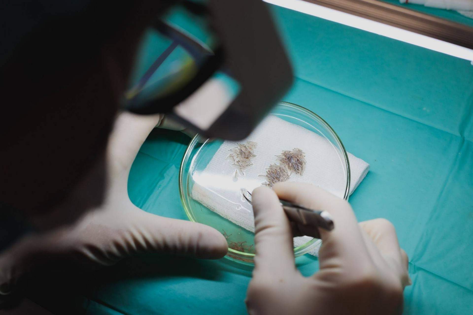 La Clínica Adcure lleva a cabo los populares microinjertos de barba y cejas