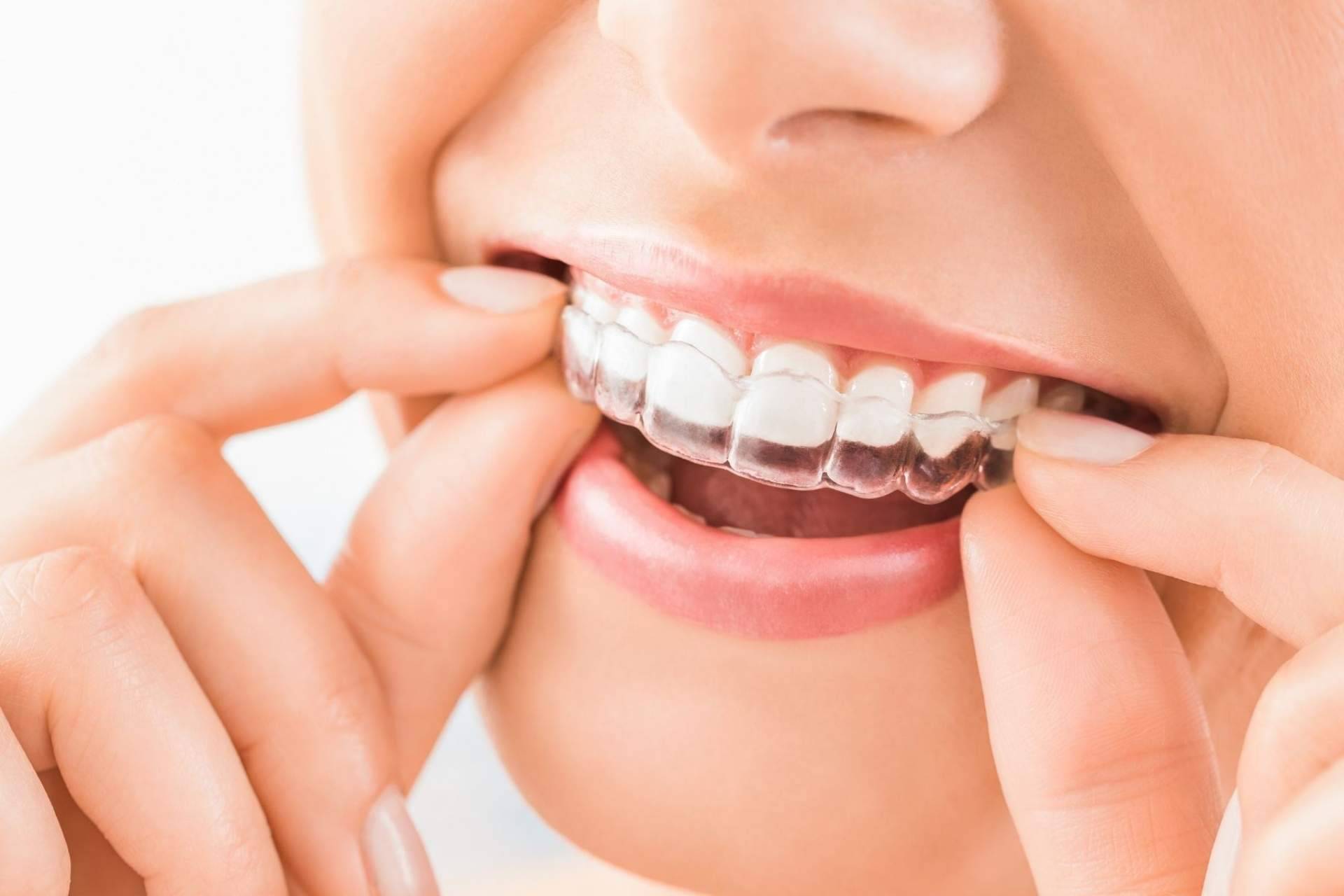 Clínica Viasalud: ¿La estética dental ofrece un efecto rejuvenecedor?