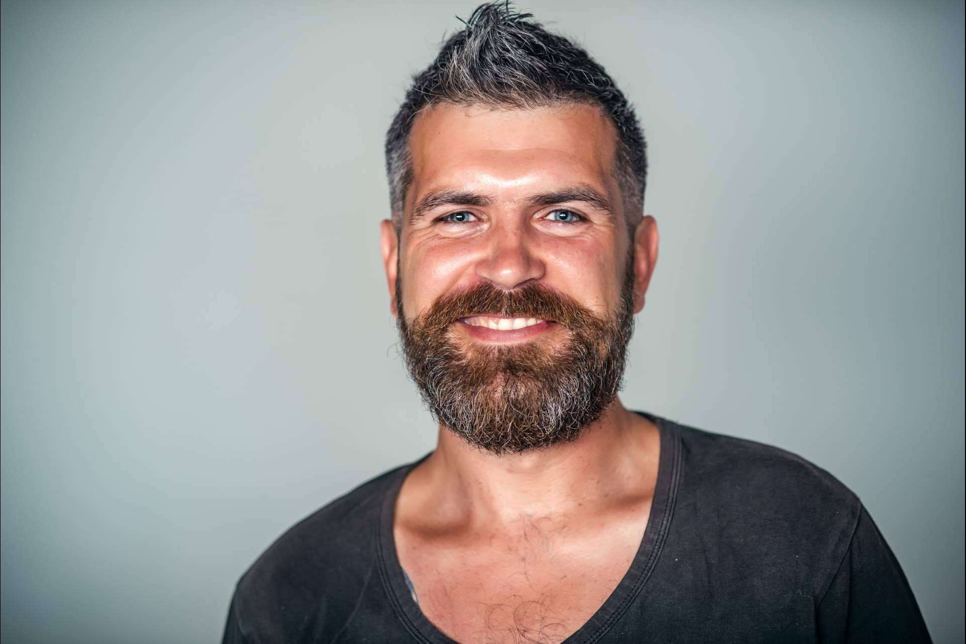 El trasplante de barba de Clínicas Dr. Pelo, uno de los tratamientos con resultados más satisfactorios