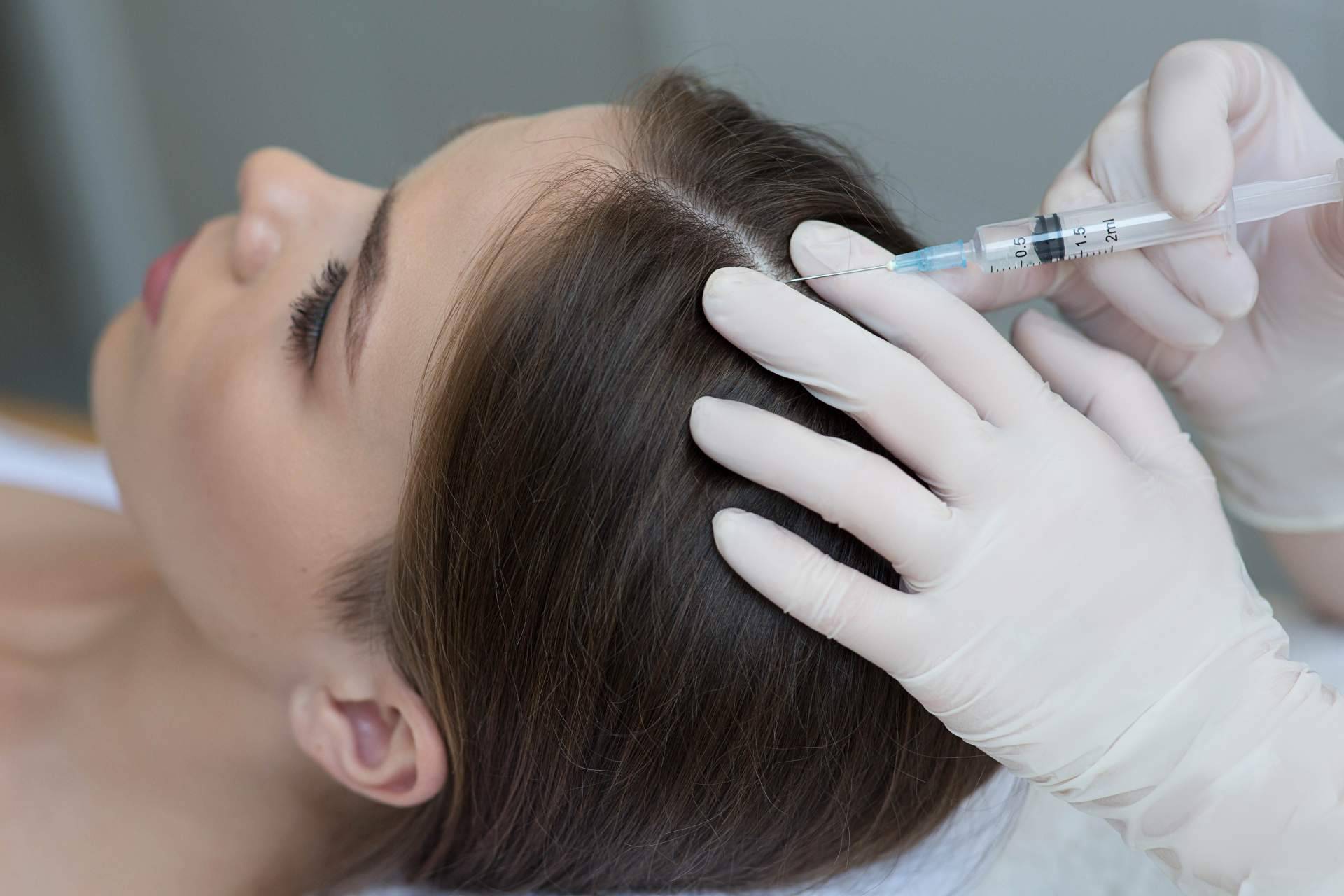 ¿Láser capilar o mesoterapia capilar? Tratamientos de Élite Capilar