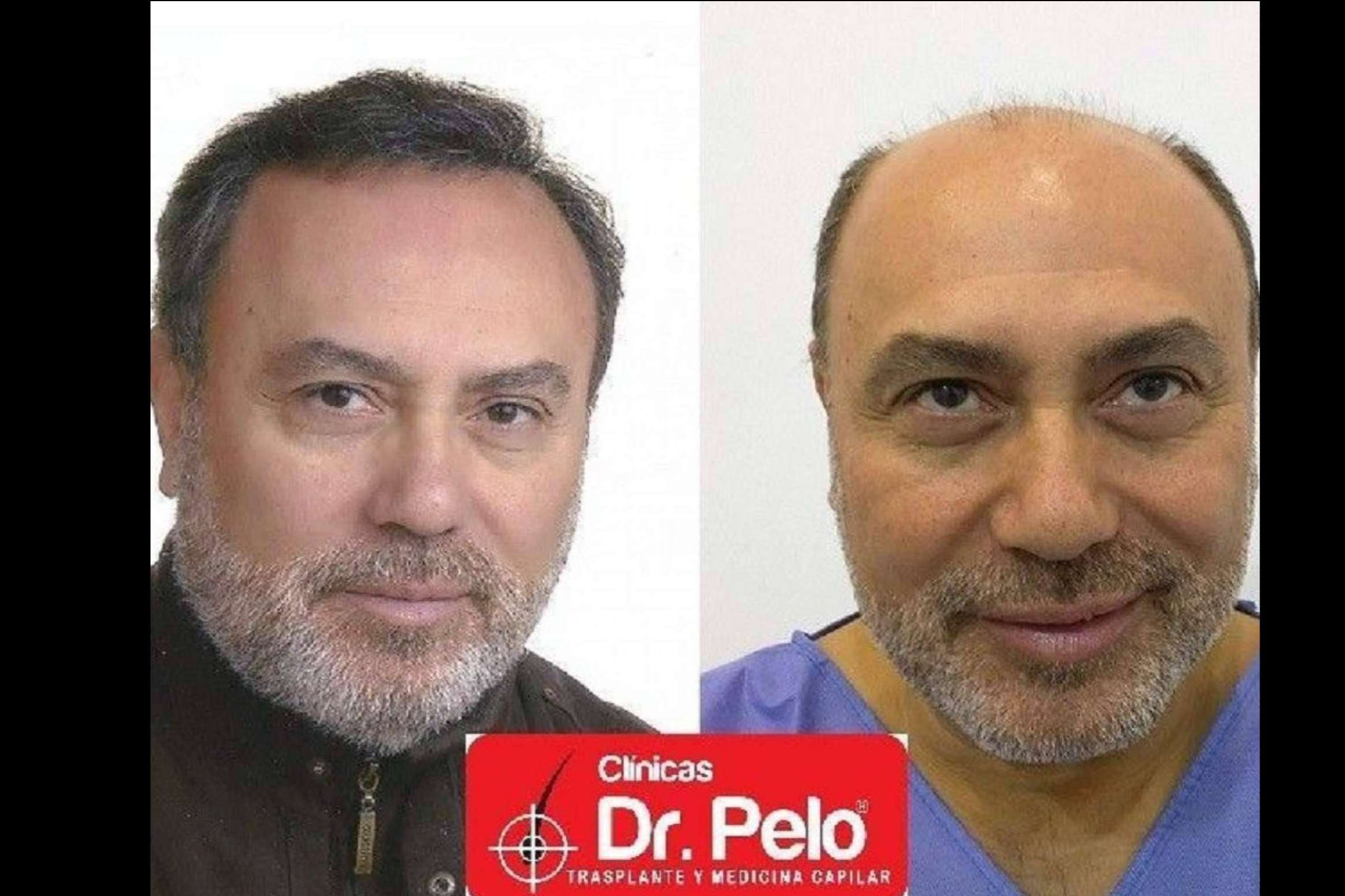 La red de Clínicas Dr. Pelo dispone de todo tipo de tratamientos capilares