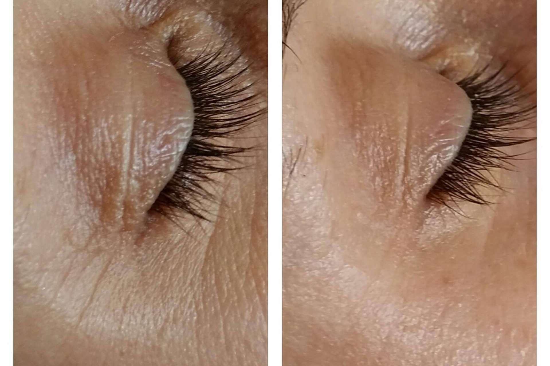 Tratamiento facial antimanchas para conseguir una piel de porcelana y otros tratamientos faciales icónicos de la compañía MiCleo&Co