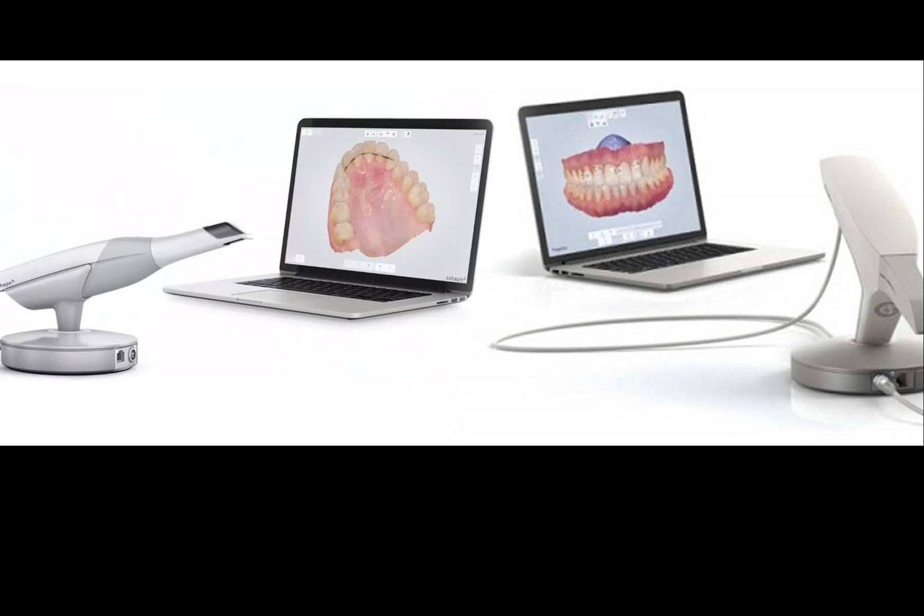 Los servicios de la clínica dental Implant Clinics en la toma de registros con 3Shape TRIOS, un escáner de última tecnología