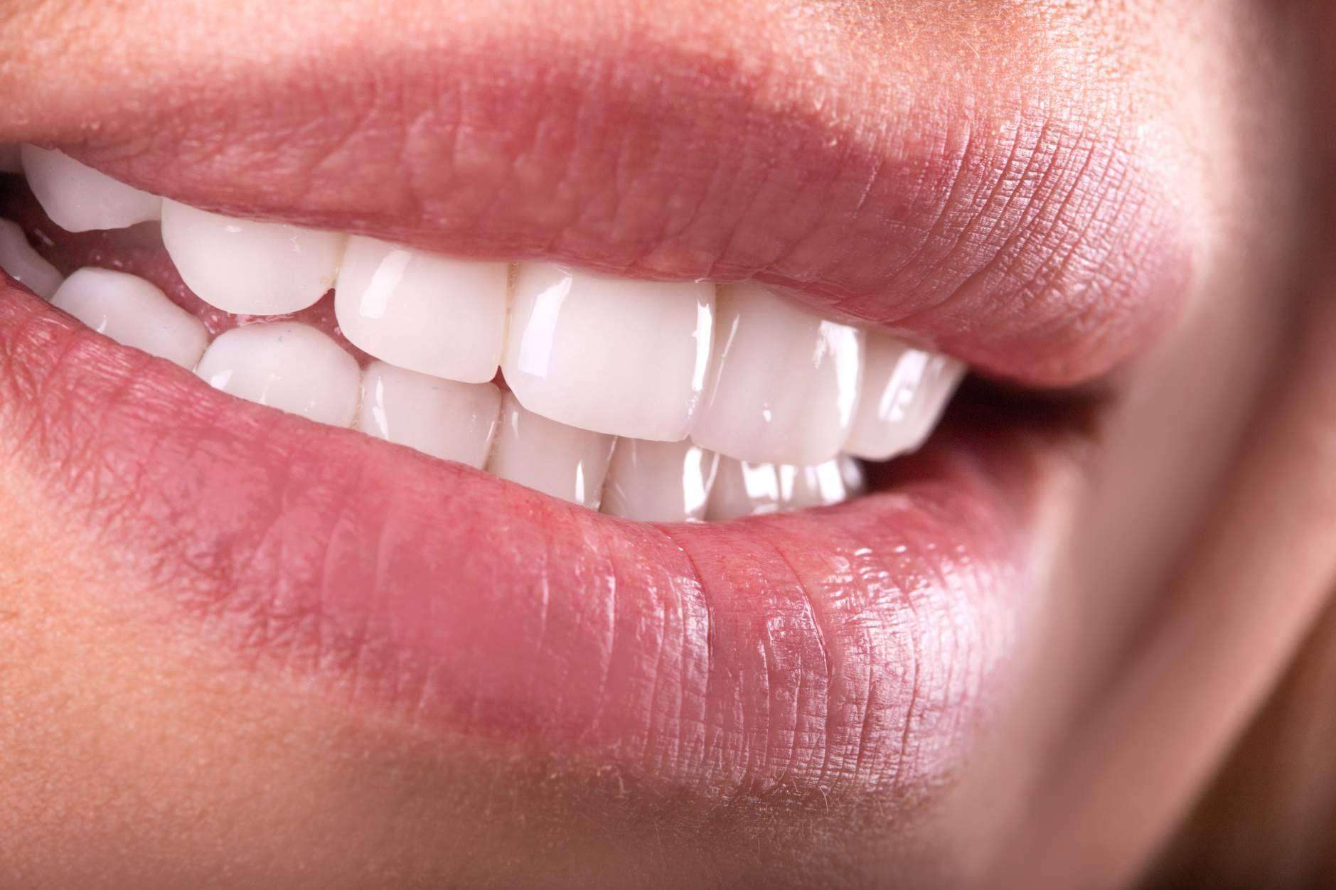 La profesionalidad y la calidad en implantes dentales de Clínica Sonrisas de Corrales Dental
