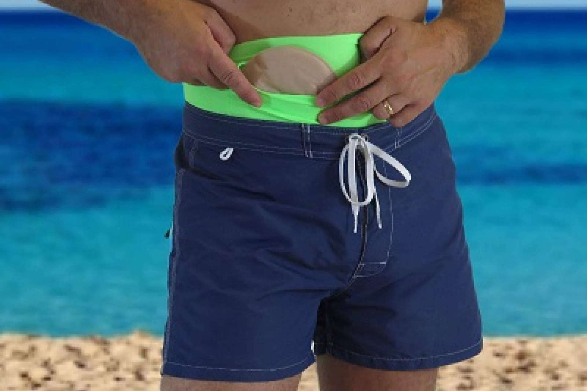 Maldita Hernia, las fajas para bañarse en la piscina con una ostomía