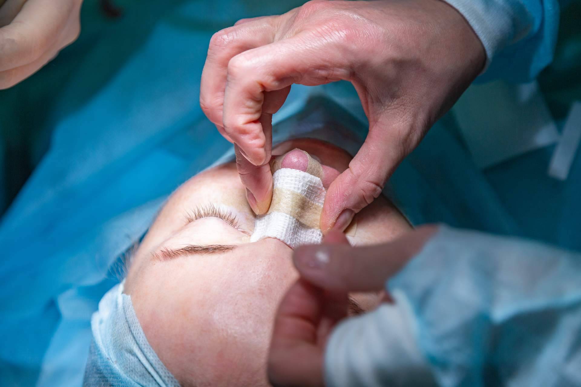 Model Bell realiza cirugías plásticas de nariz y rinoplastias ultrasónicas