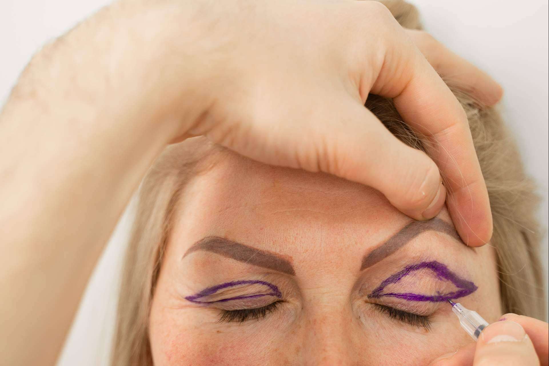La blefaroplastia sin cirugía llega de la mano del plasma láser de Alluring Clinic