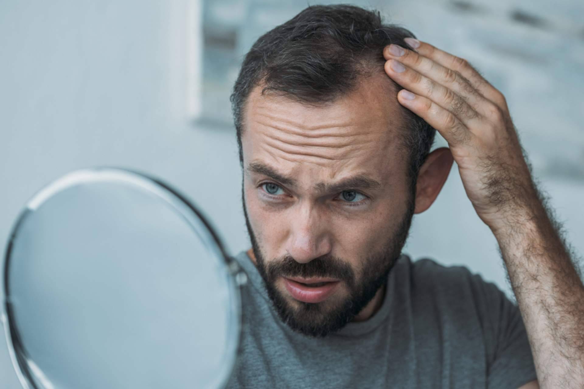 Xpecia Tablet, una alternativa para combatir la alopecia de la mano de Saw Palmetto