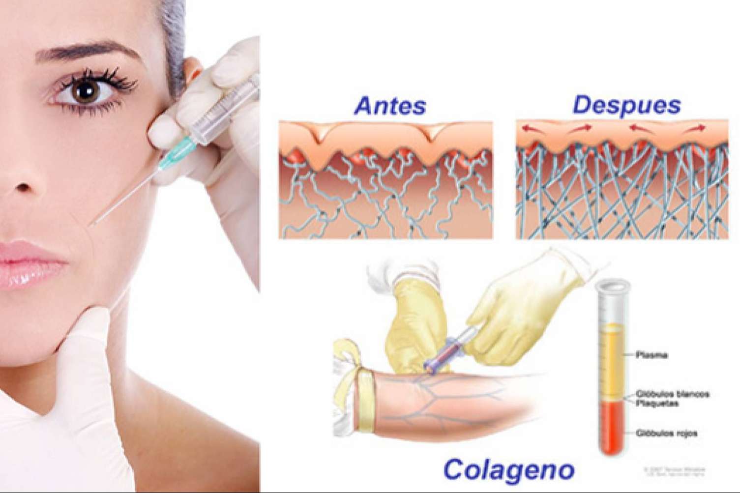 Combatir los signos del envejecimiento con el PRP facial de KōAN Club