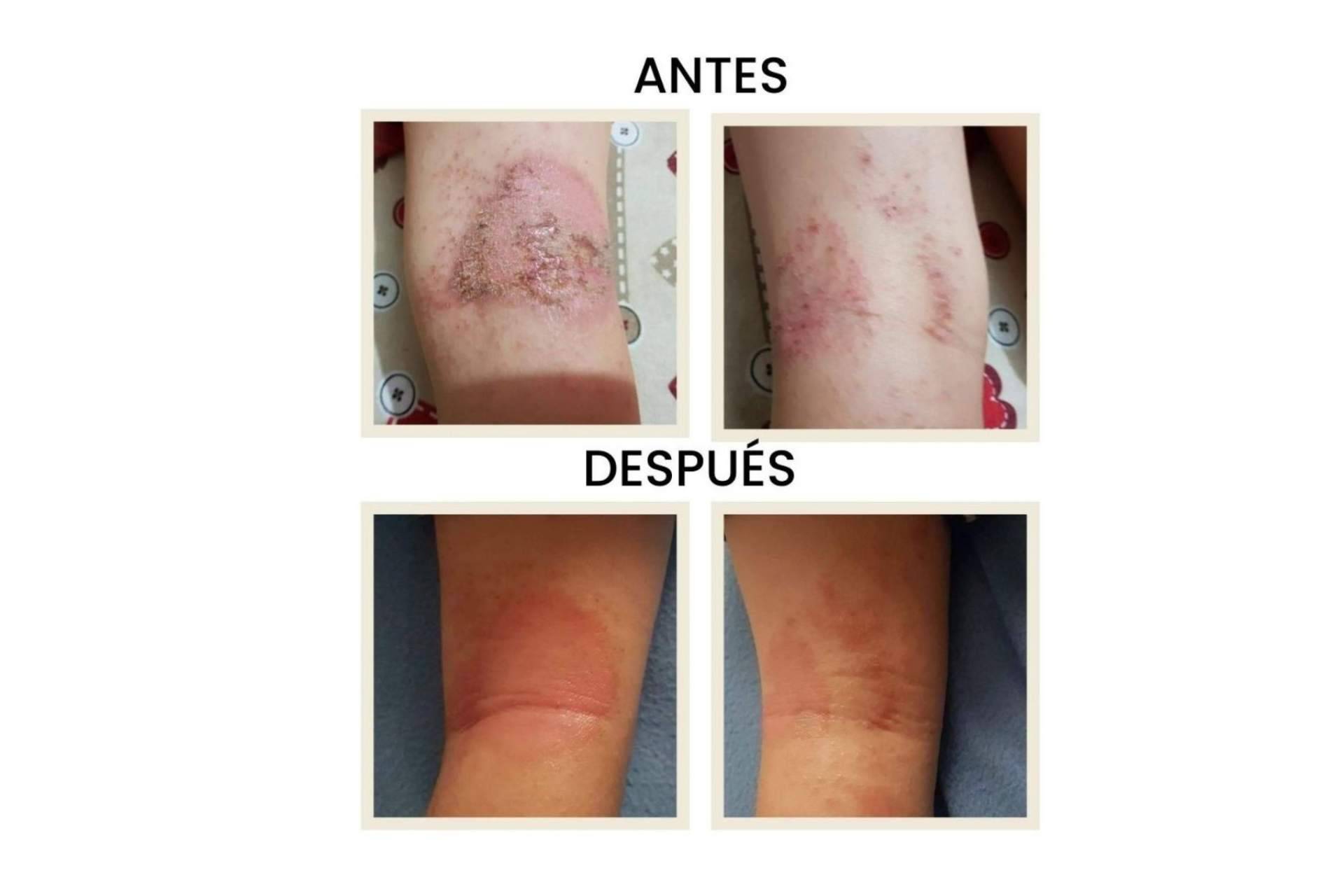 Plan de expansión de Green Cornerss en el canal físico, farmacias y parafarmacias