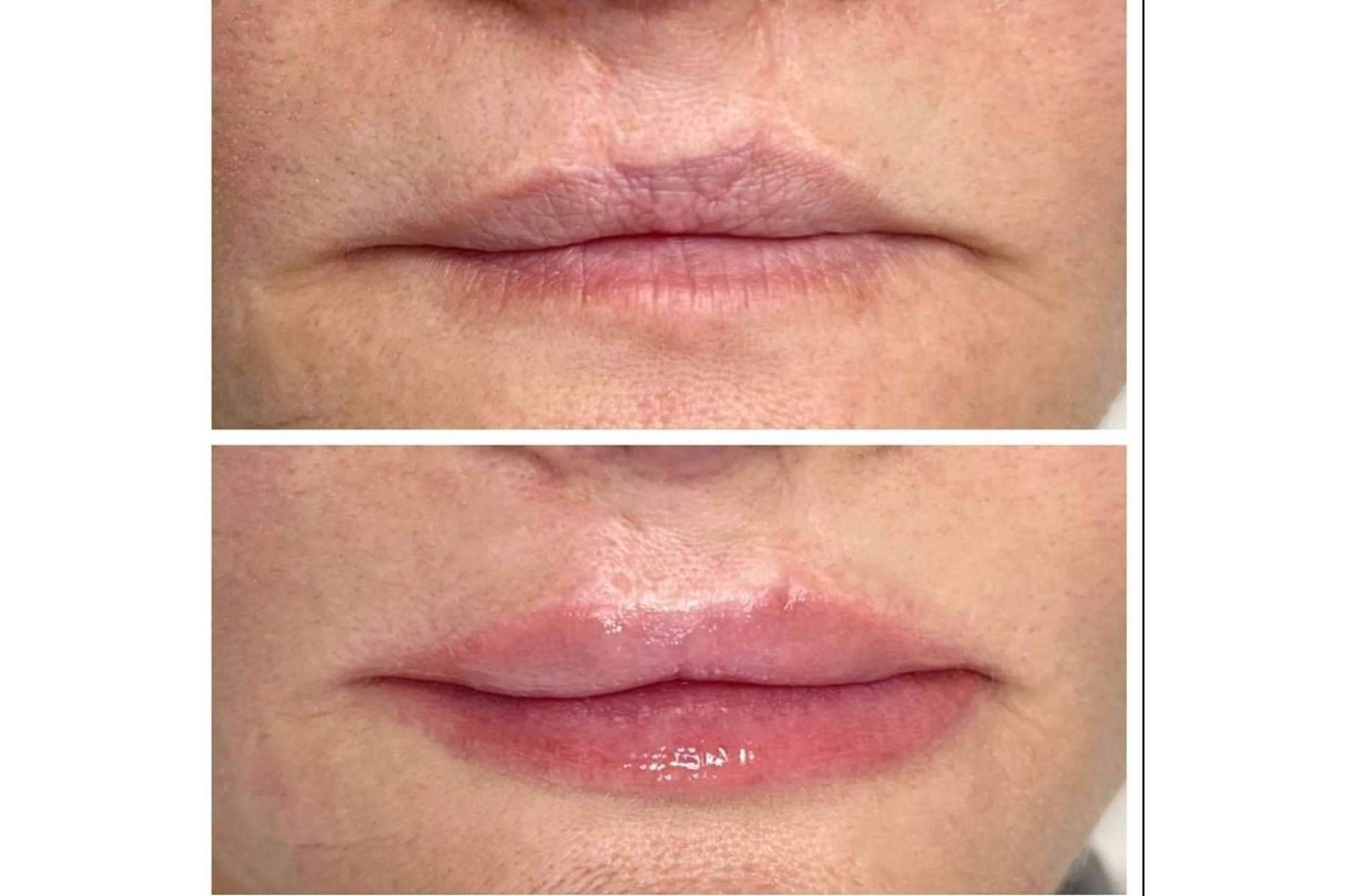 La amplia experiencia en la industria de la medicina estética de RL Clinic