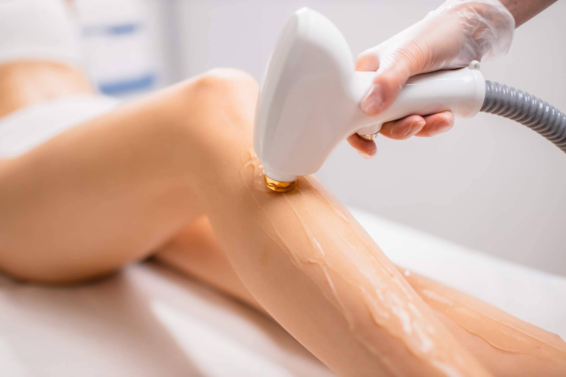 Clínica Zero ofrece un servicio de depilación laser