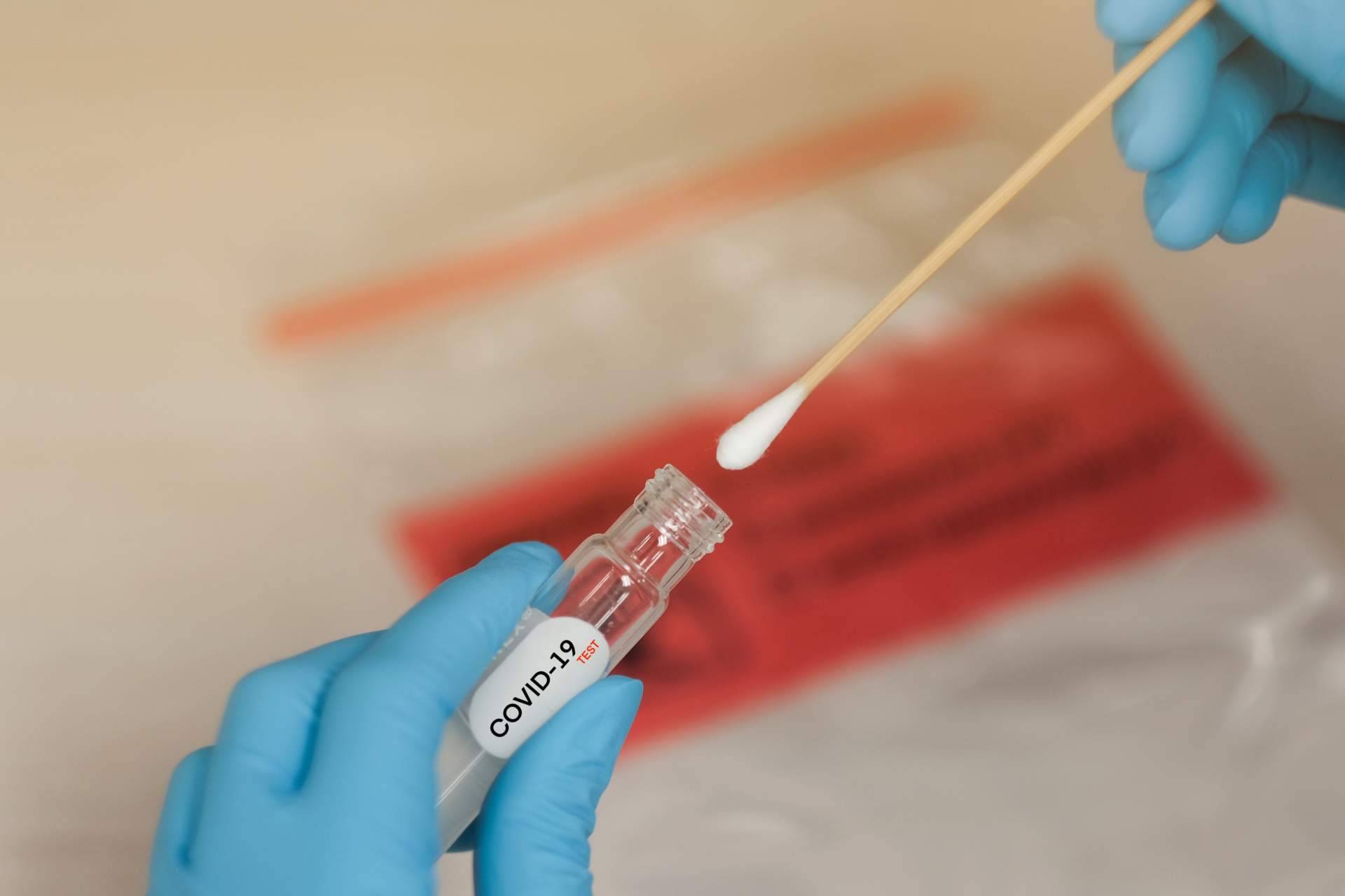 La importancia de haber utilizado el test covid para las fiestas navideñas, de la mano de Centro Médico Bravo