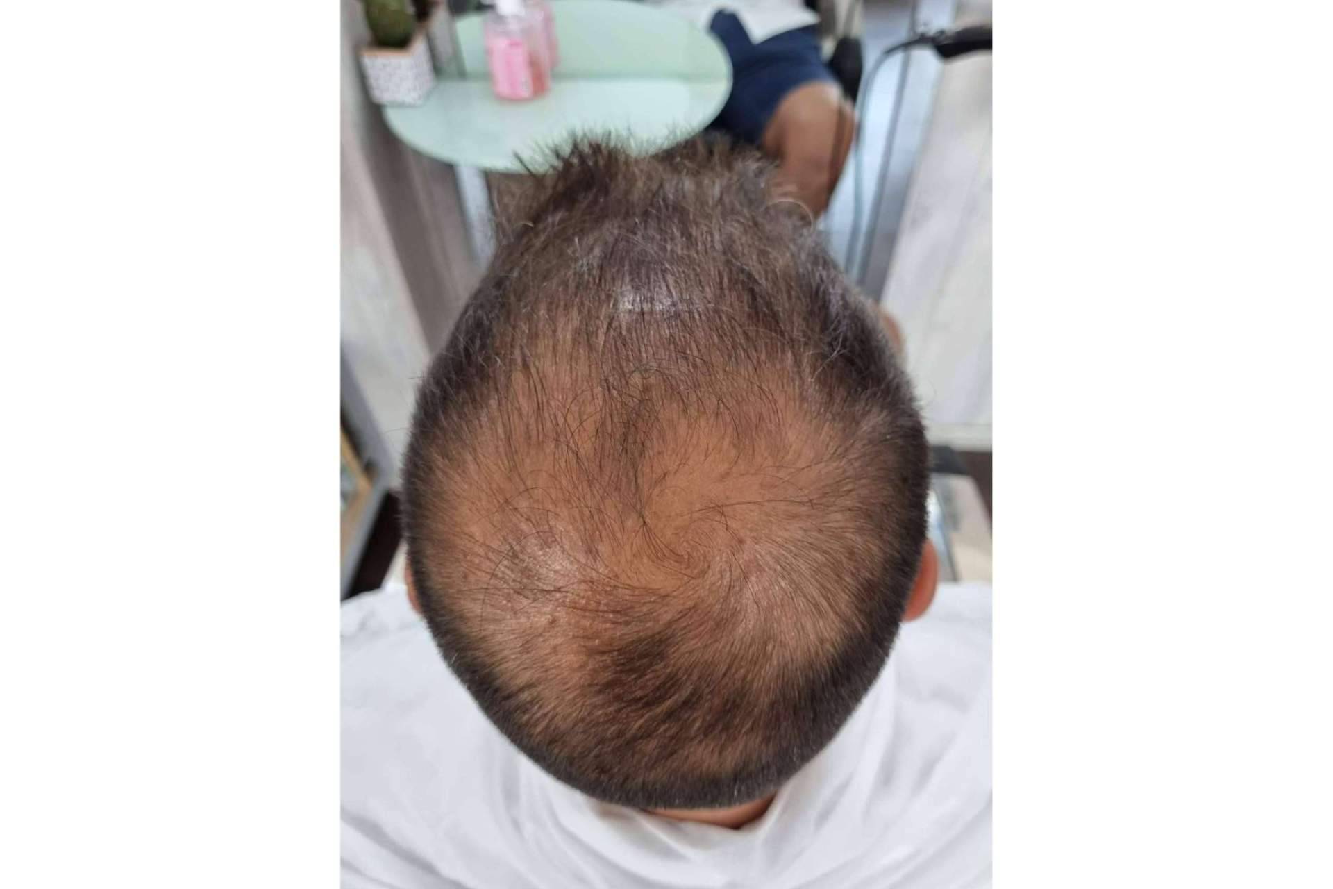Lion Hair habla sobre las fibras capilares