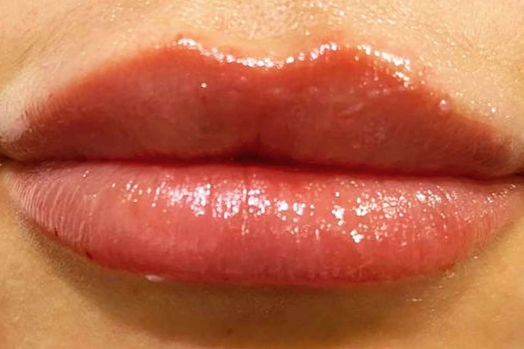 El tratamiento facial completo para mejorar el aspecto de la piel de Clínica Amalfi