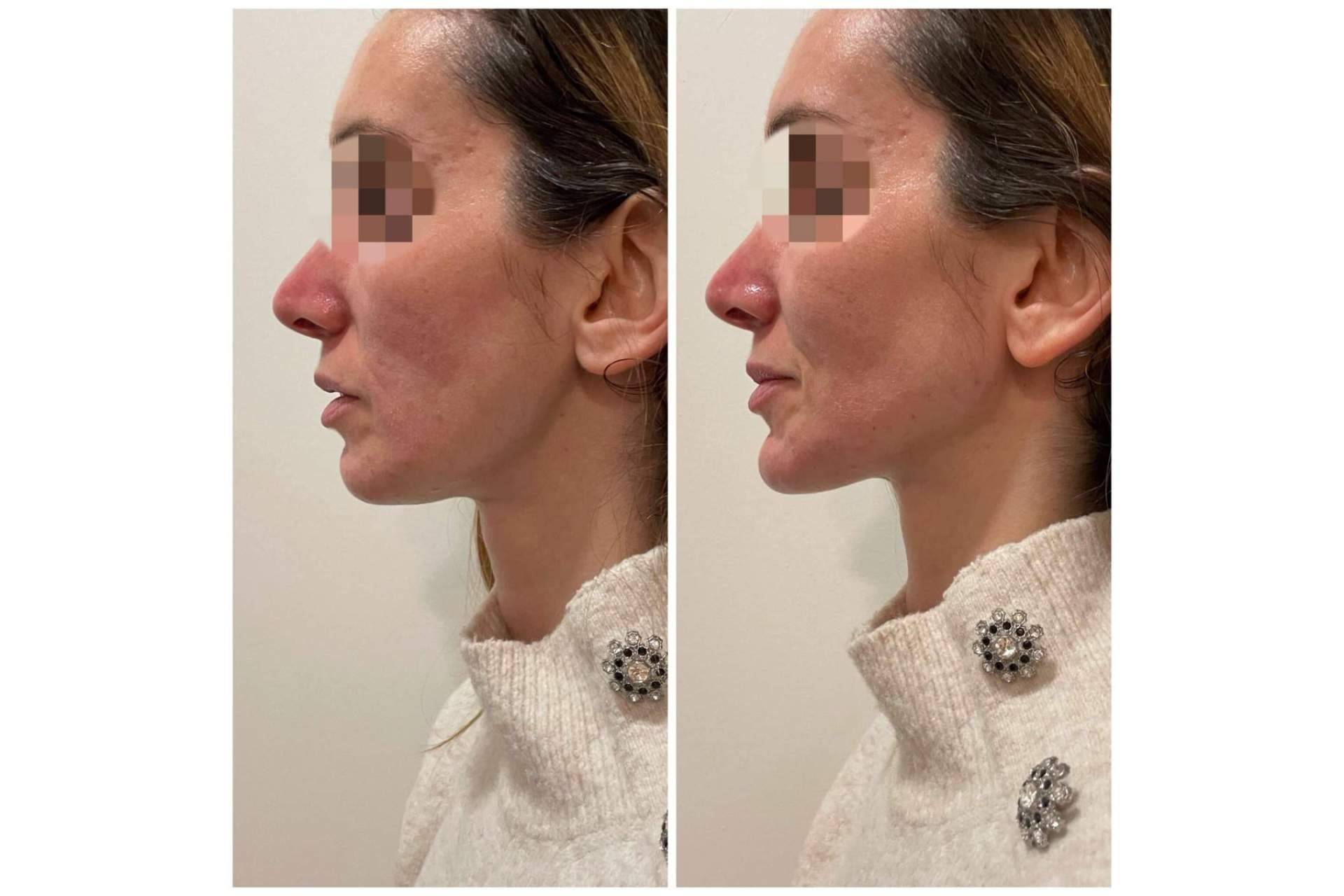 Dónde y por qué realizarse una marcación mandibular, de la mano de Cecilia Arthur