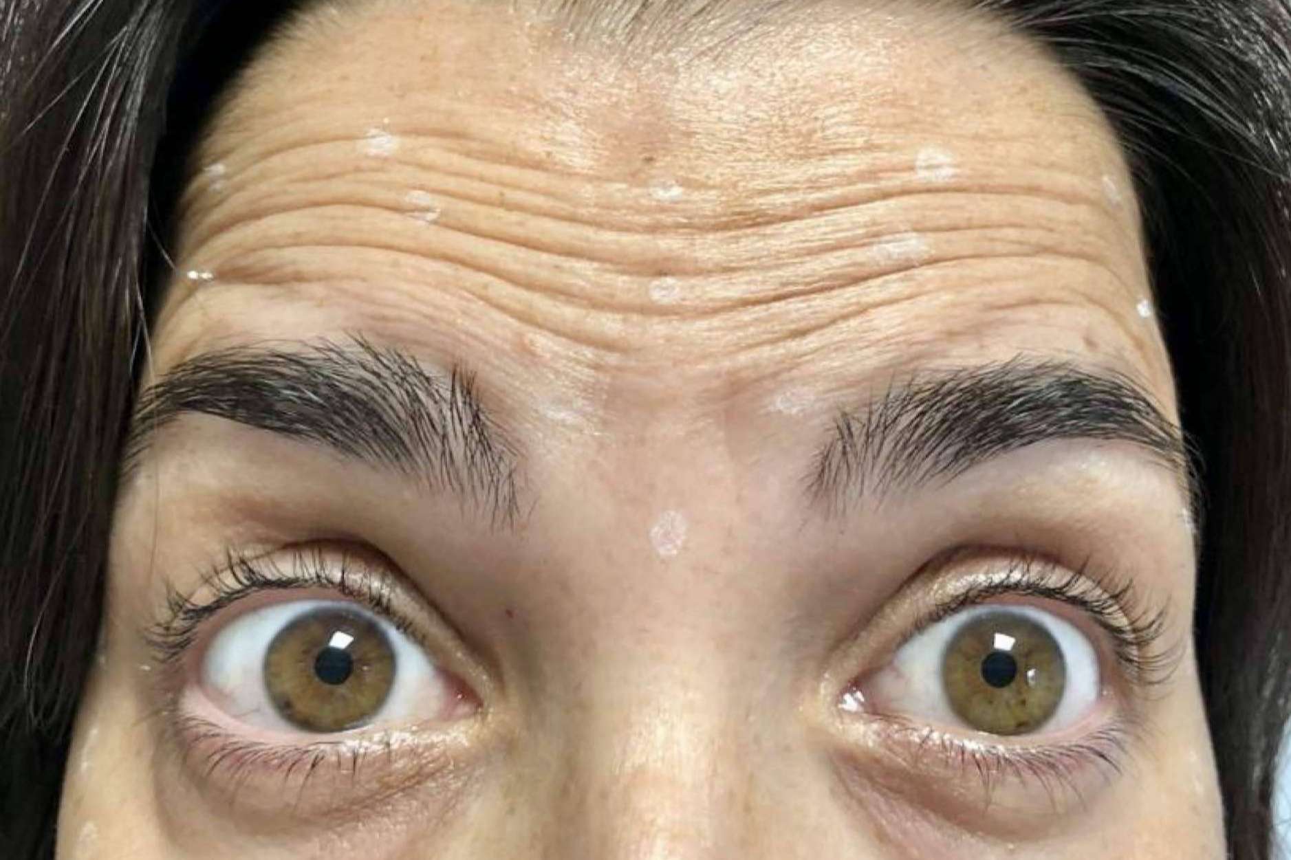 Clínica Amalfi ofrece un tratamiento de rejuvenecimiento facial para lucir un aspecto joven y natural