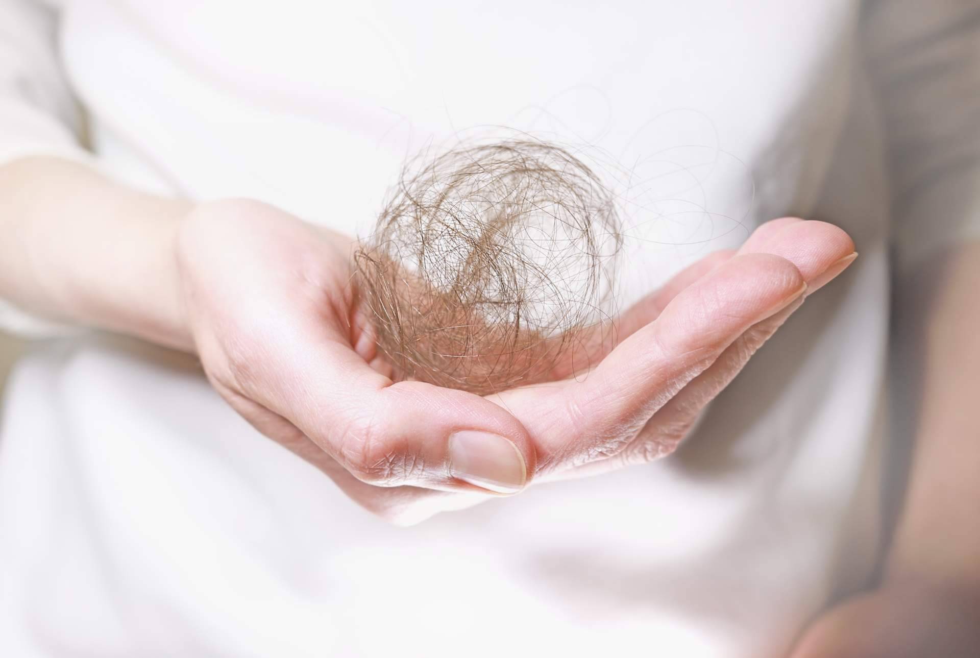 La alopecia andrógenetica femenina y la solución de Capilar Innovation Clinic