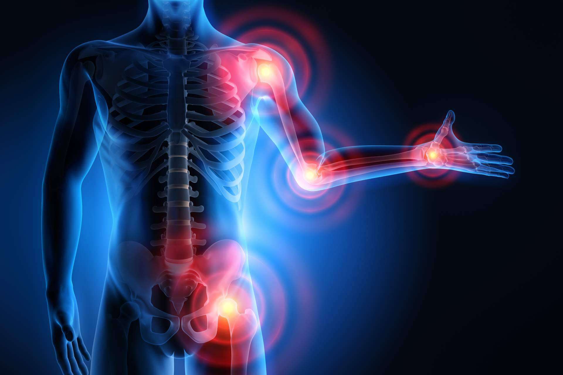 Cuidar de las articulaciones con OLIMINAFlex®, que tiene resultados probados en estudio clínico