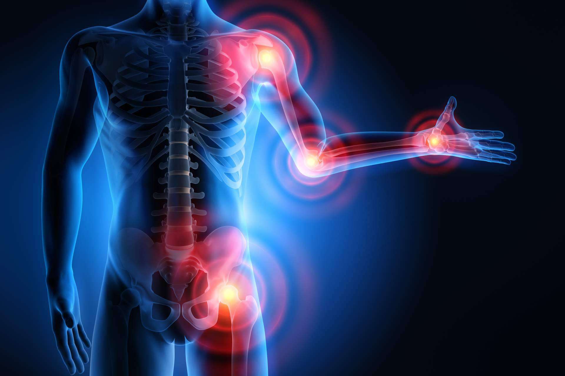 ¿En qué consiste el osteoartritis tratamiento de Phytogen Medical Foods?