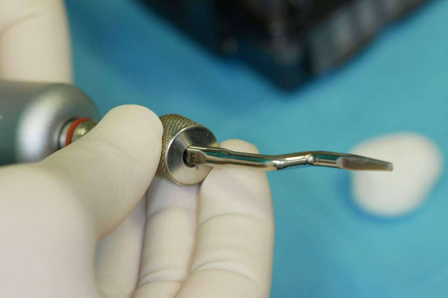 ¿Dónde encontrar especialistas en recuperar la sonrisa y la salud bucodental con implantes dentales cerámicos? Clínica Biorigenera