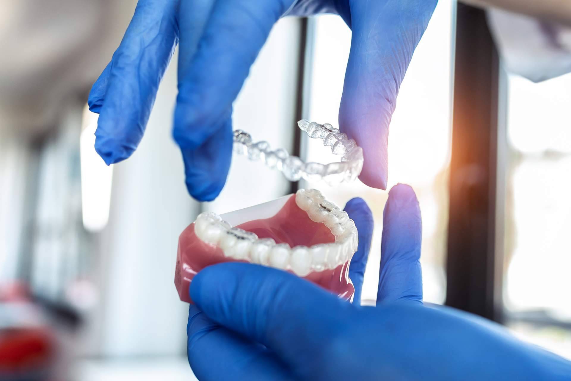 Tratamiento de ortodoncia invisible en la clínica Lola Escalante Estudio Dental
