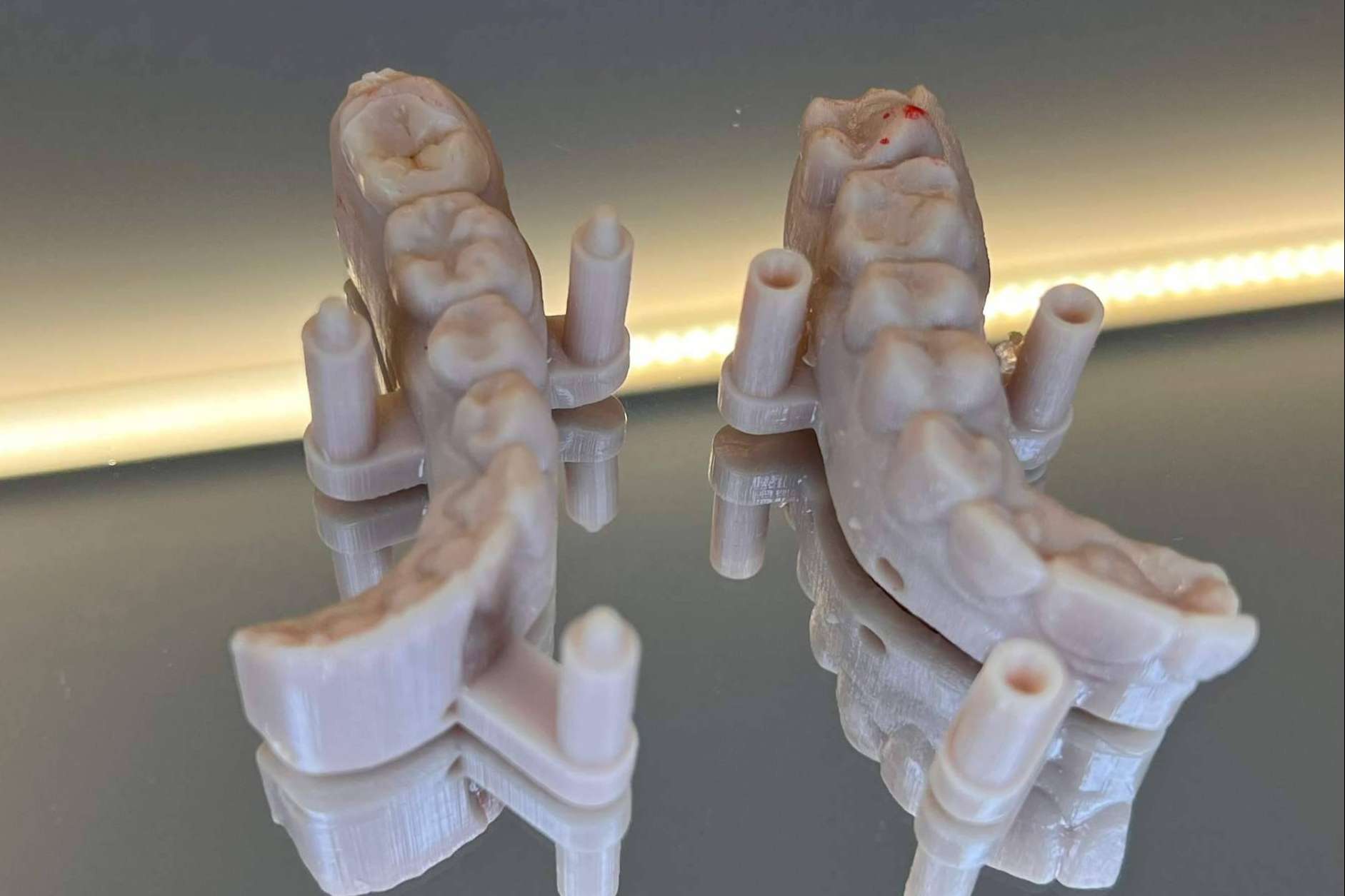 Implantes en el día con tecnología 3D en la sonrisa, de la mano de Dentinova