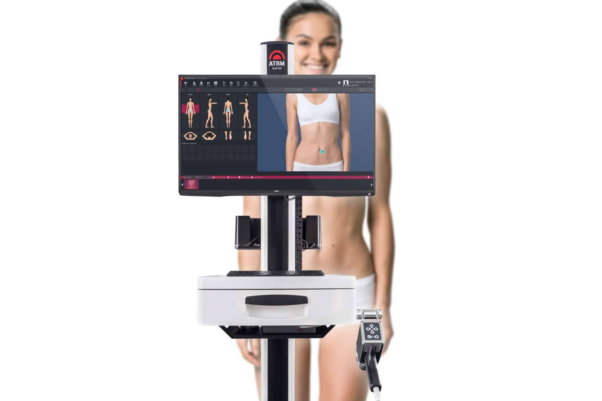 Los equipos FotoFinder incorporan la Inteligencia Artificial, para una dermatoscopia más precisa