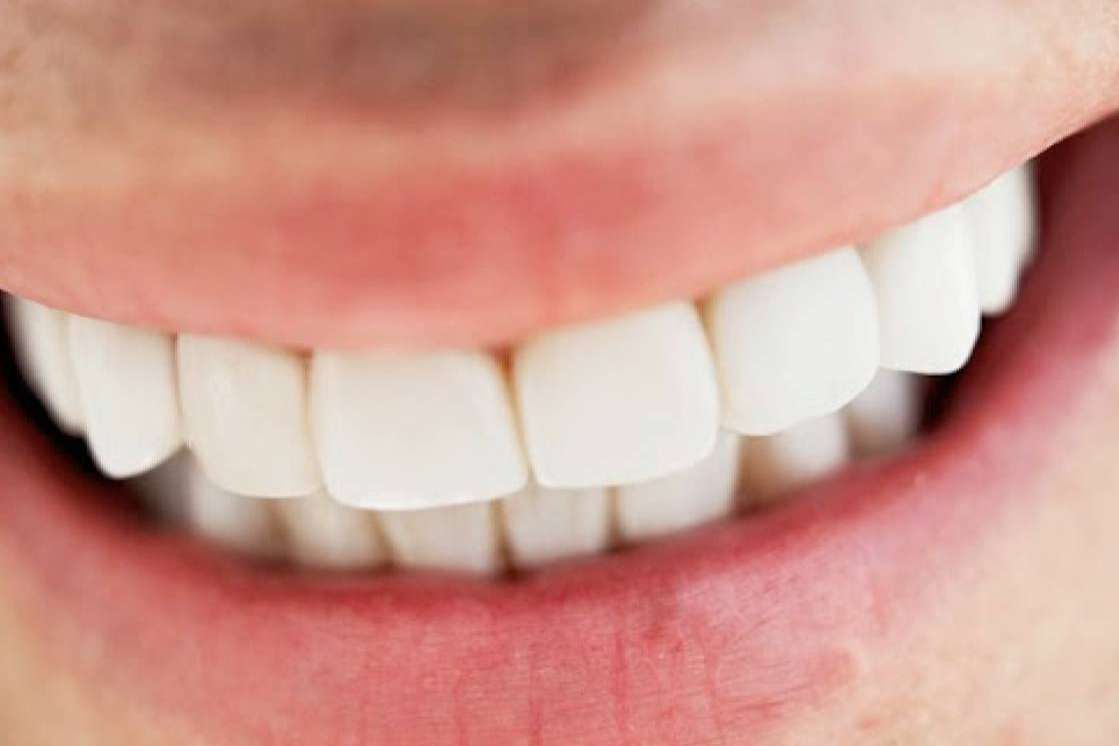 La solución definitiva en implantes dentales está en Clínica Dental Jorge del Corral