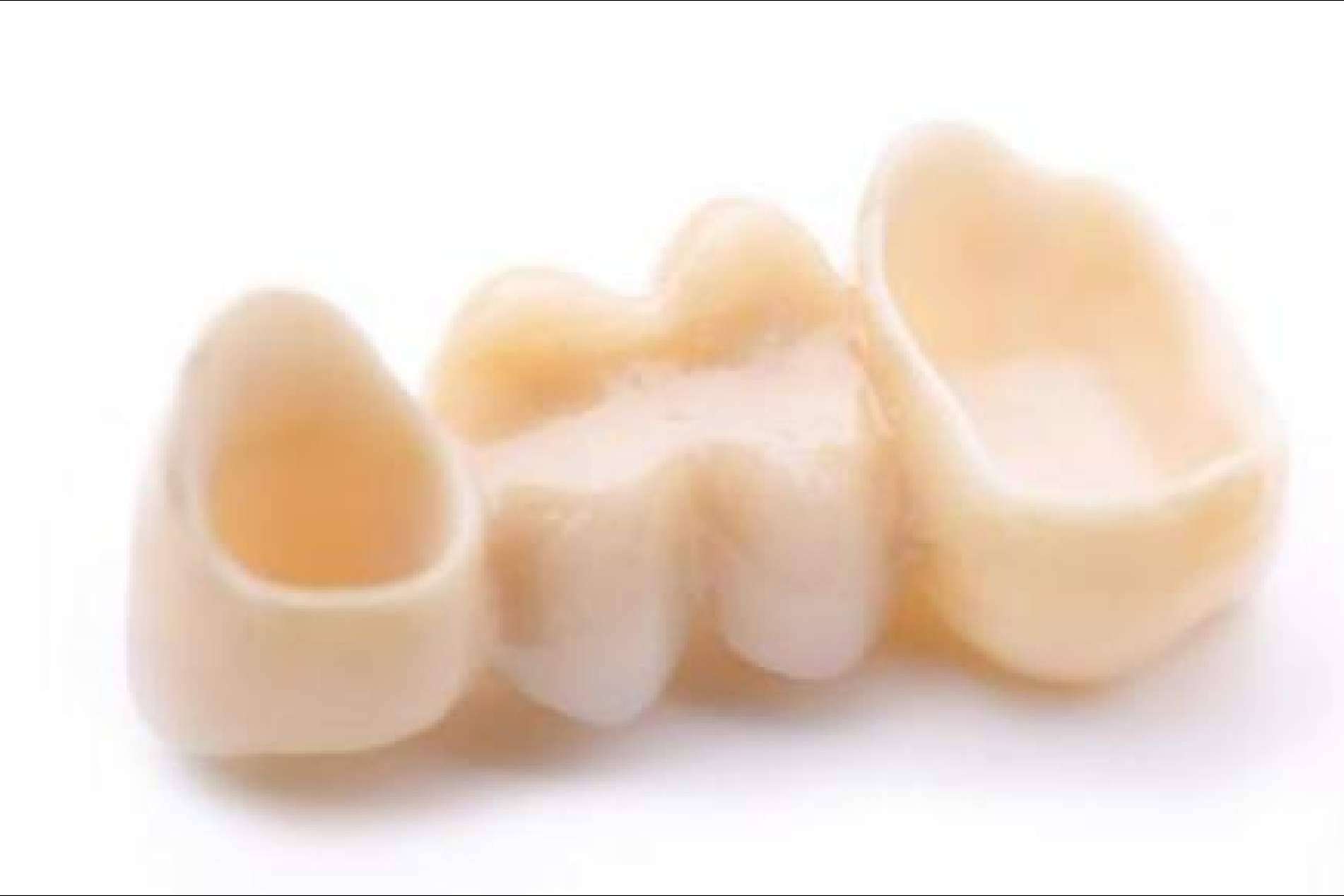 Clínica Dental Jorge del Corral en Hortaleza, Madrid; calidad en prótesis fija estética de zirconio