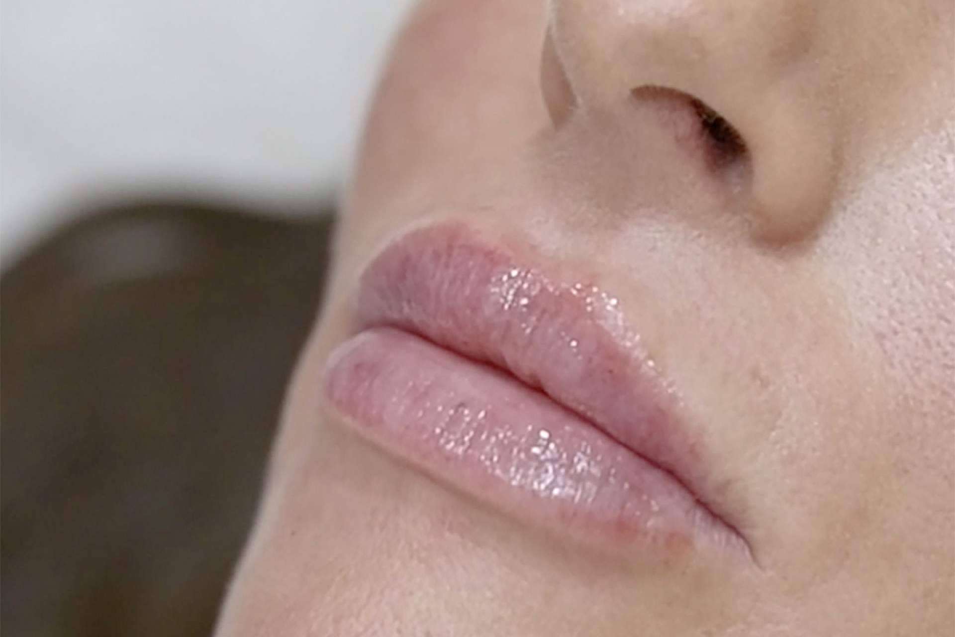 Holaglow revoluciona la armonización labial con Glow Lips, un tratamiento de precisión y naturalidad