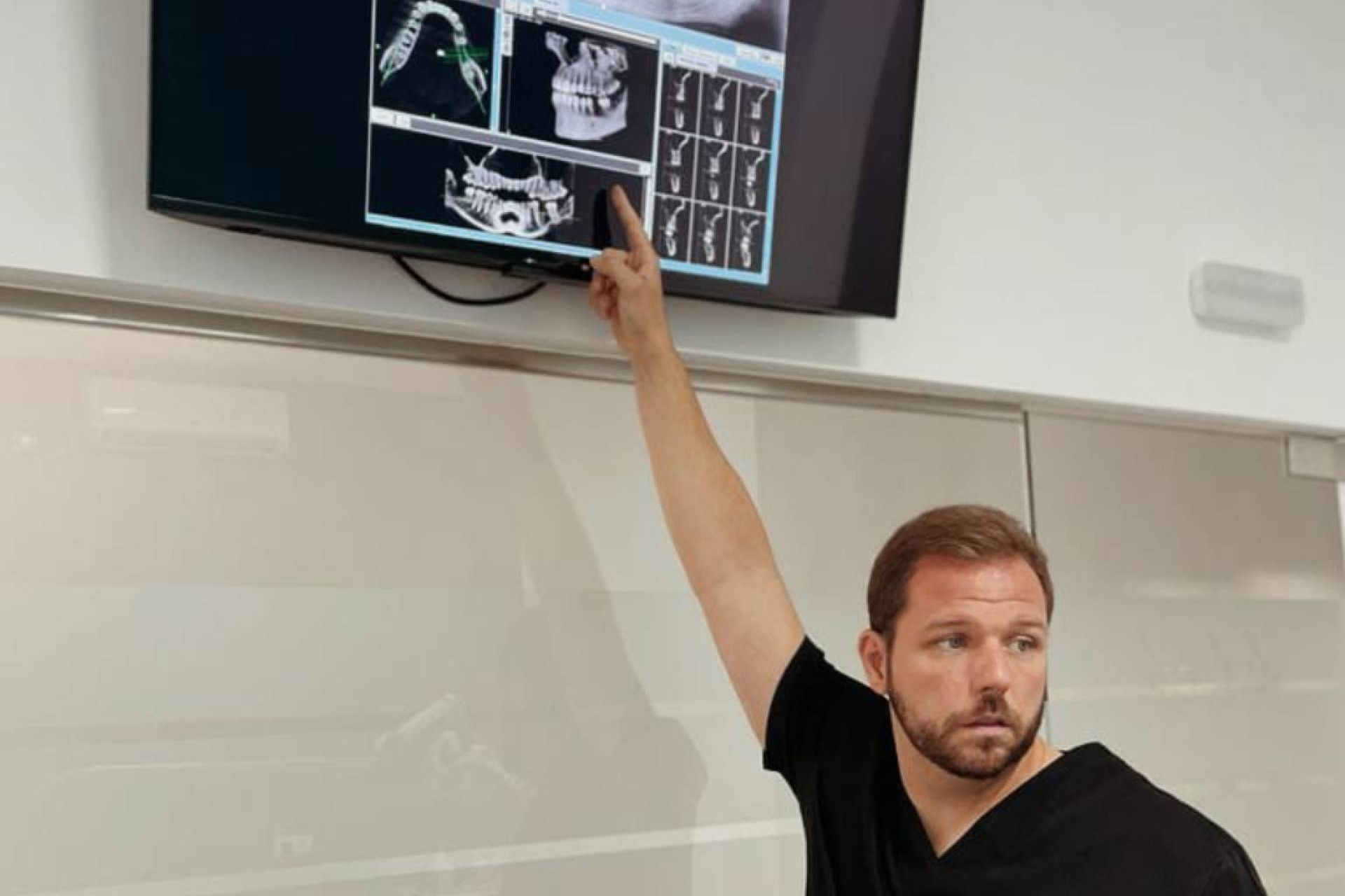 Implantes dentales con carga inmediata, la propuesta de BR Dental Móstoles con BR Immediate Smile